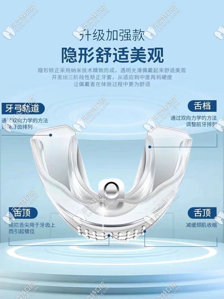 巴貝奇牙套特點(diǎn)