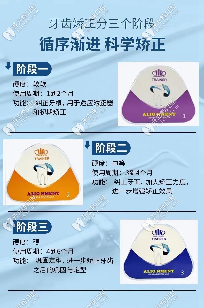 巴貝奇牙套的三個(gè)階段