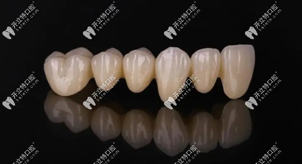 牙齒貼面和全瓷牙哪個(gè)好kelete.com
