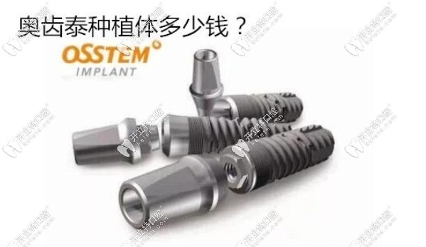 韩国Osstem种植牙的费用