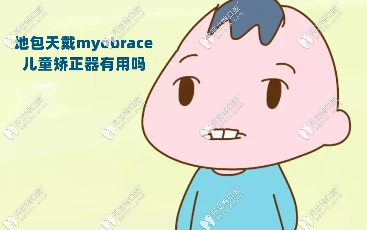 地包天戴myobrace兒童矯正器有用嗎