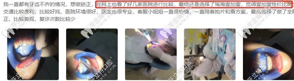 在此矯正8個(gè)月的客戶這么說