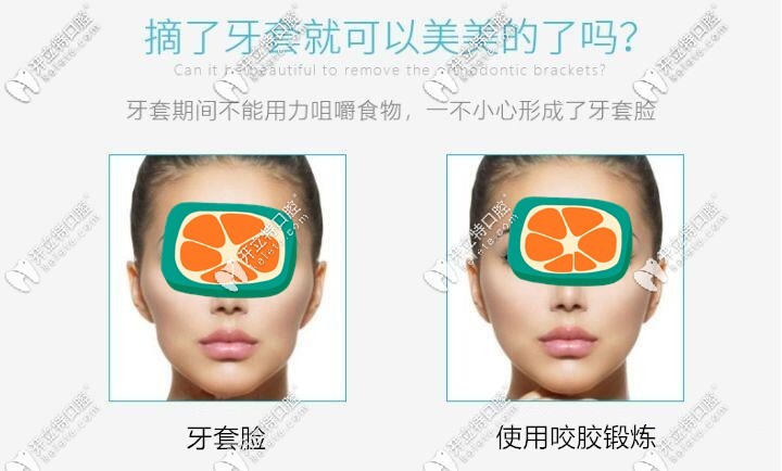 咬膠怎么用防止牙套臉