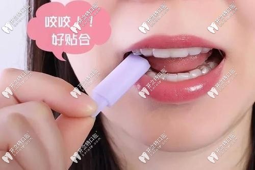 隱形牙套咬膠