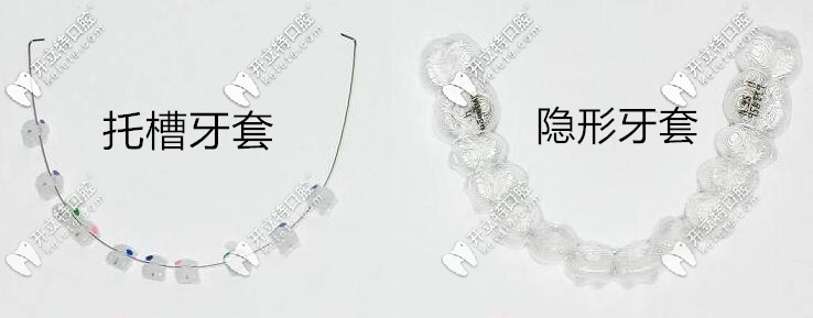 托槽牙套和隱形牙套的區(qū)別