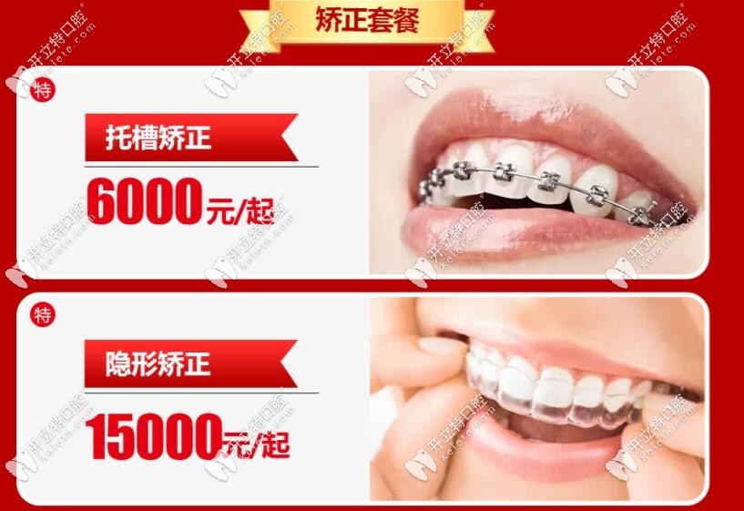 石家莊威邇口腔牙齒矯正價(jià)格