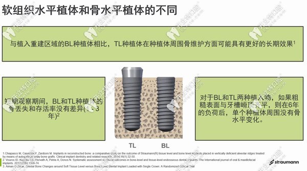 軟組織水平種植體與骨水平植體的不同