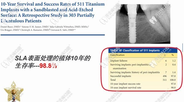 瑞士ITI種植體10年表面處理的生存率