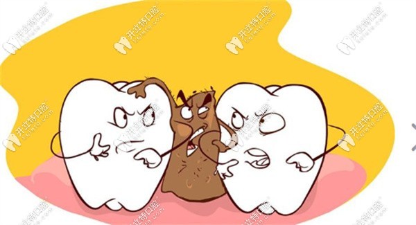 牙齒黑三角有什么危害