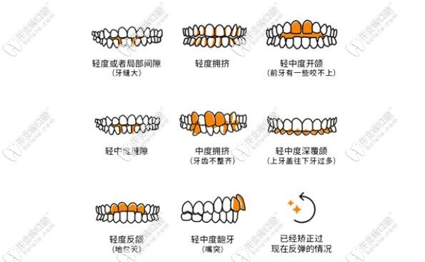 easysmile矫正病例