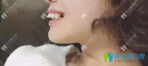 深覆蓋圖解