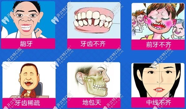 精准微矫正适应症