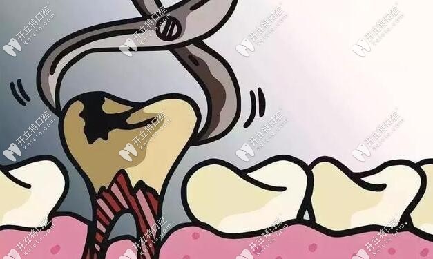 拔牙也要盡快