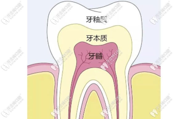 牙釉質修復