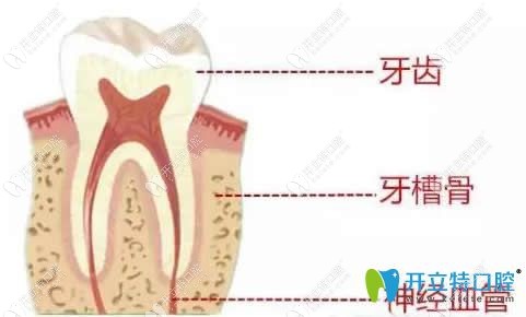 牙齒矯正對牙神經(jīng)有沒有傷害