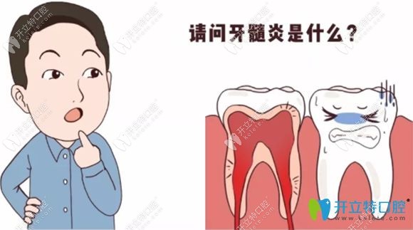 牙髓炎的治療方法和價(jià)格