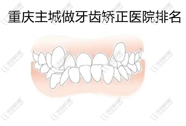 重慶主城做牙齒矯正醫(yī)院排名