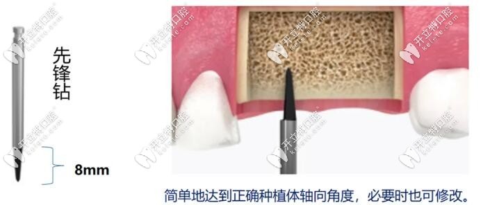 先锋钻的使用
