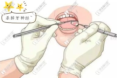 做全口烤瓷牙前需要殺牙神經