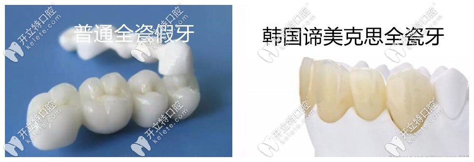 DMAX全瓷牙對比