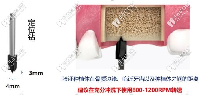 定位钻的使用及图解