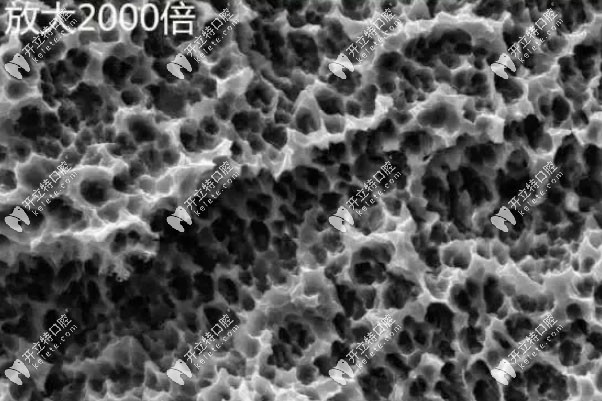 SLA表面處理技術