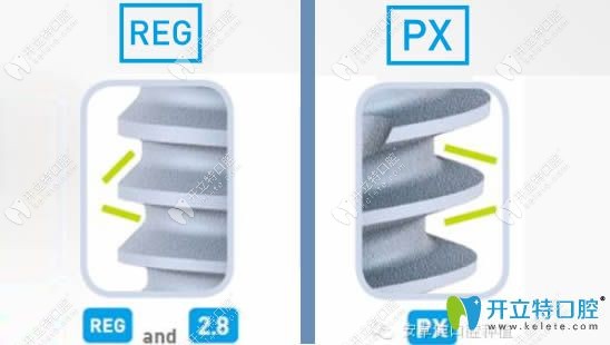 法国安卓健PX和REG的螺纹区别
