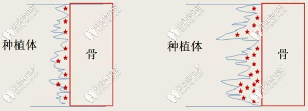 RBM處理工藝的優(yōu)勢