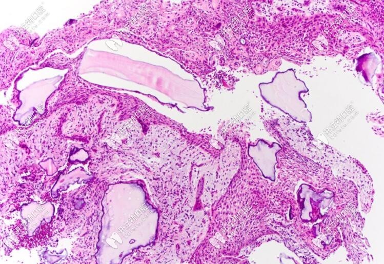 biooss放大結構圖