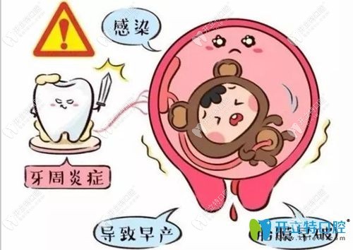 懷孕期間牙病會(huì)影響寶寶發(fā)育