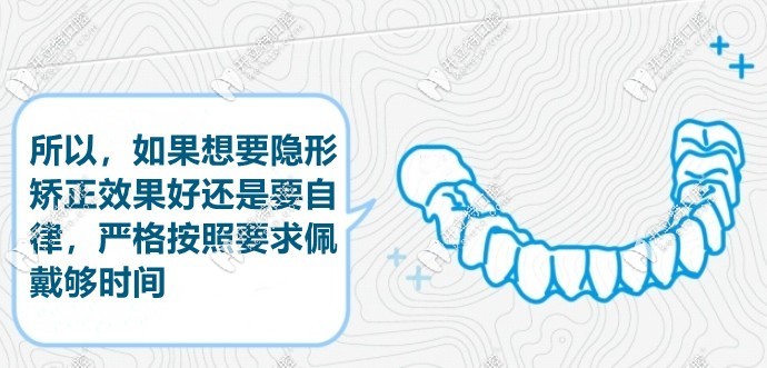 戴隱形牙套要戴夠時(shí)間