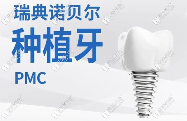 瑞典諾貝爾pmc種植牙