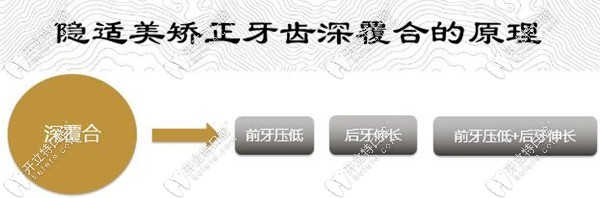 隱適美矯正牙齒深覆合的原理