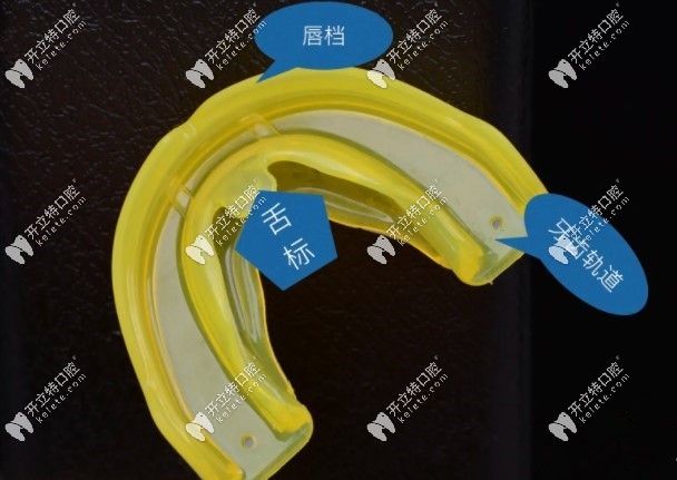 mrc矯治器的原理是什么