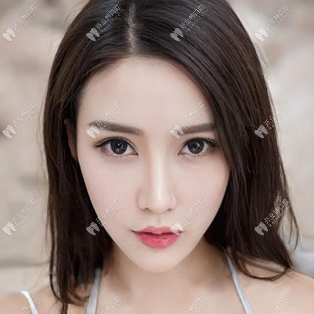 了解戴隱適美C5矯正牙齒深覆合的原理,就知道效果好不好嘍