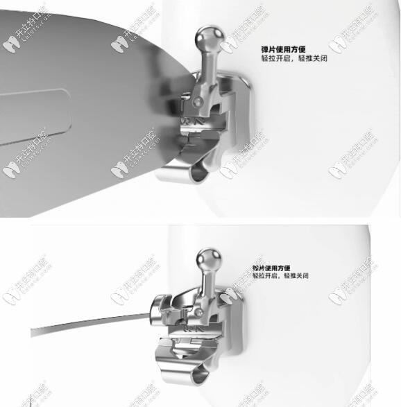 弹片使用更轻便