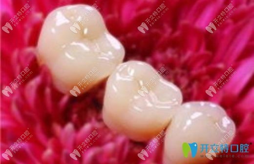 水晶鋯全瓷牙的優(yōu)缺點(diǎn)介紹