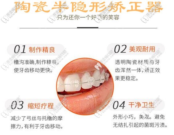 陶瓷半隱形矯正器