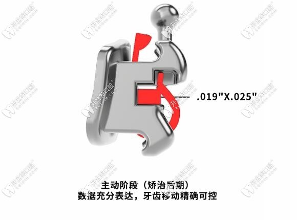 矫治后期精准控制