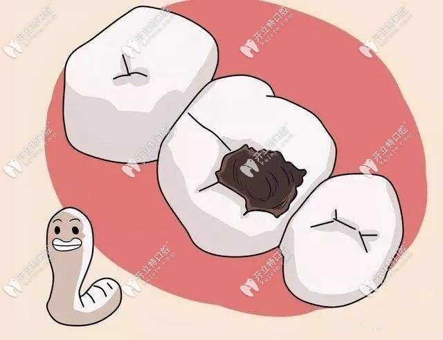 齲齒轉(zhuǎn)變?yōu)殪o止齲