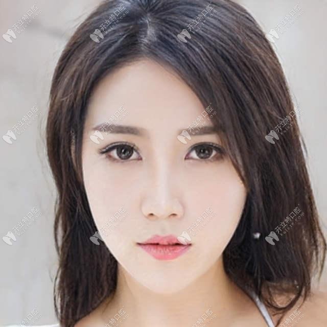 談活動義齒佼佼者：純鈦活動假牙價格及有沒有副作用