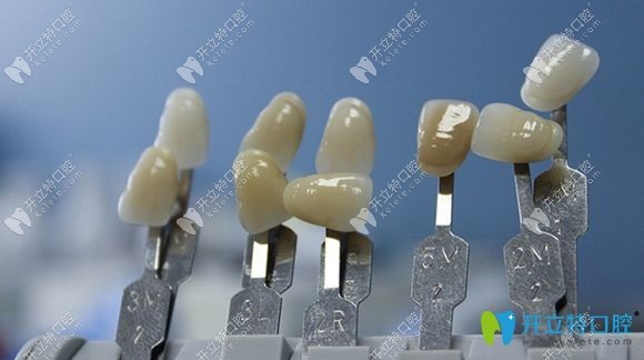 水晶鋯全瓷牙的優(yōu)缺點(diǎn)介紹