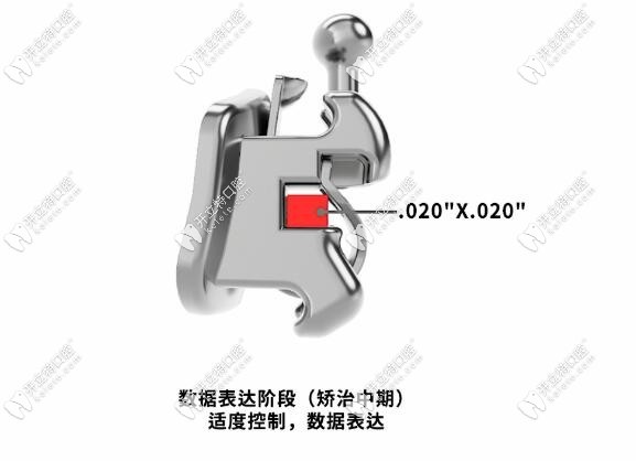 矫治中期适度控制