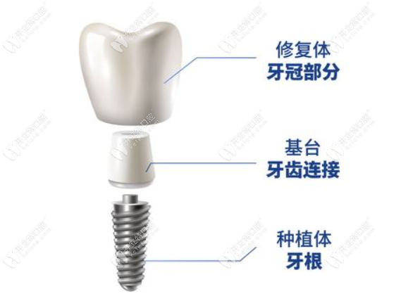 西安文景路中諾口腔醫(yī)院種植牙怎么樣