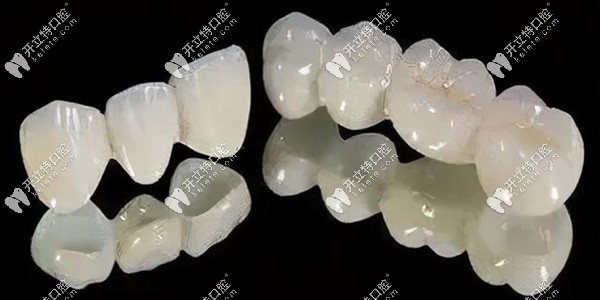 德國威蘭德適用于后牙修復(fù)