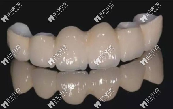 威蘭德全瓷牙材質(zhì)比較好m.kelete.com
