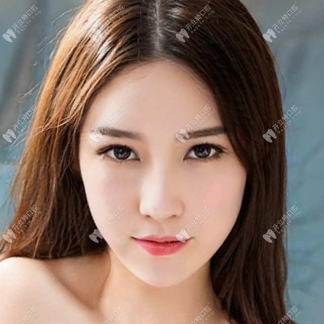門牙缺失需要間隙保持器嗎？它的種類有許多該怎么選擇