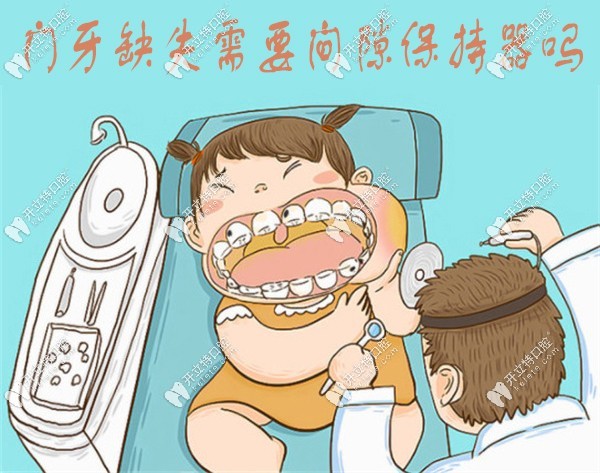 門牙缺失需要間隙保持器嗎