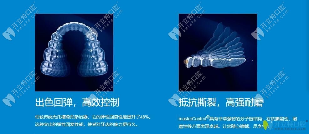 時(shí)代天使隱形矯正材料優(yōu)點(diǎn)