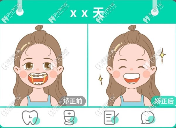 矯正牙齒前后對比
